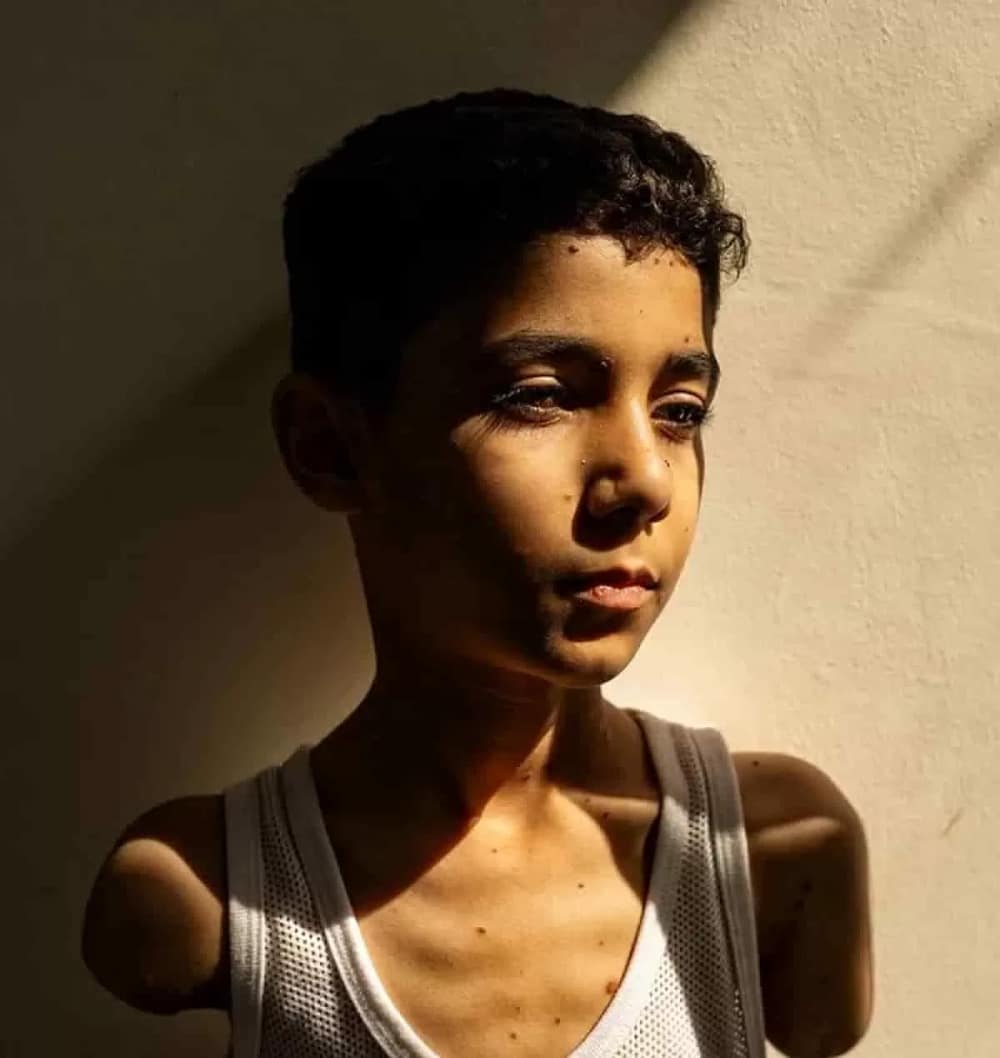 Portrait of Mahmoud Ajjour, a young Gazan Boy by Palestinian photojournalist Samar Abu Elouf wins World Press Photo of the Year
